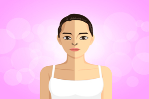 维生素e乳能去痘印吗