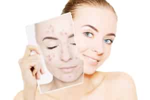 脸跌伤破皮怎么办