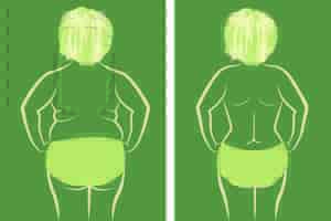 小腿排肠肌怎么变小