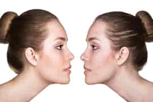 眼袋发青怎么办 眼袋发青怎么办