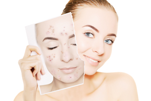 脸部出小黑点怎么回事