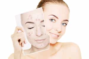 长斑是什么原因引起的